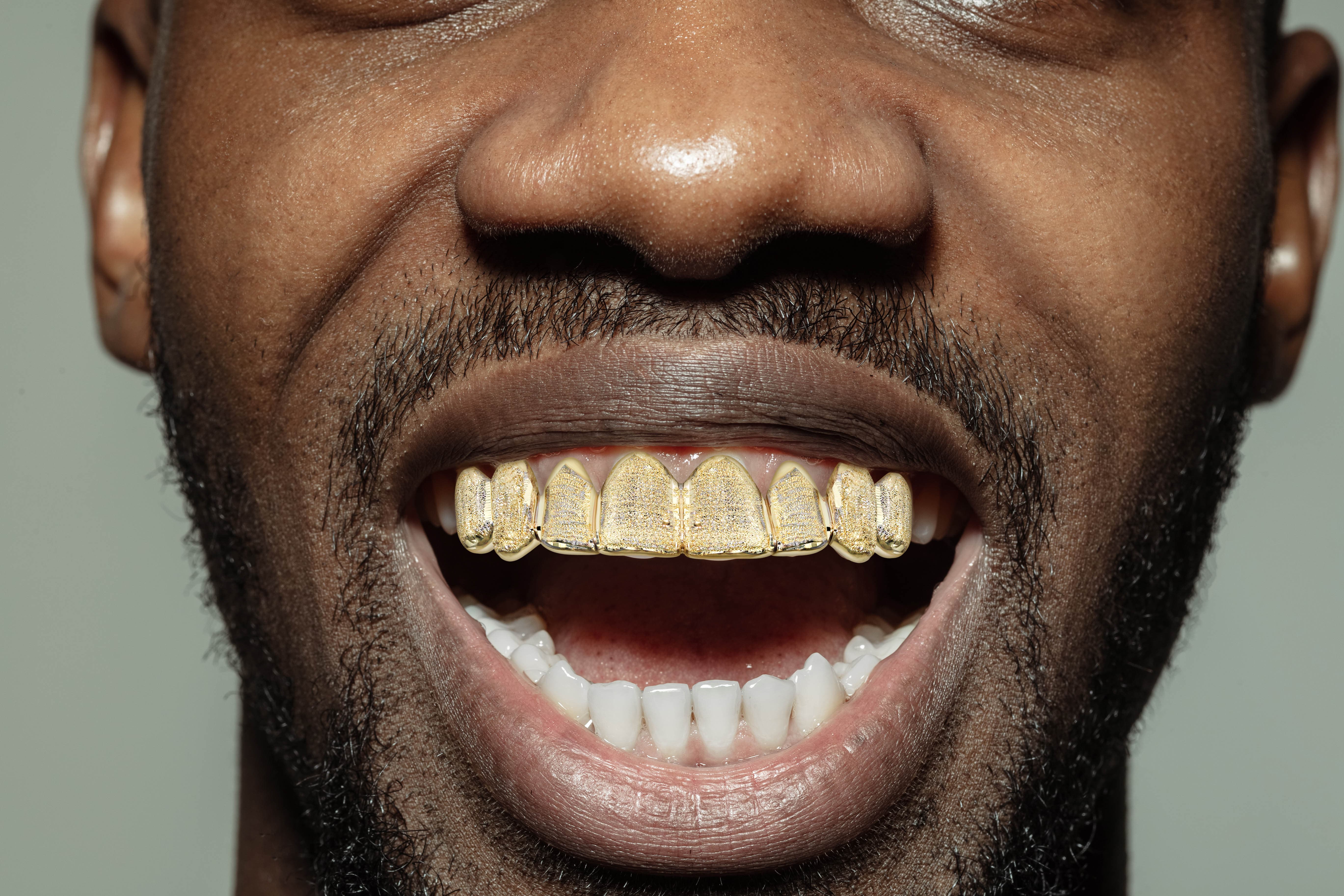 Gold 8 Teeth Diamond Cut Grills - Image 4