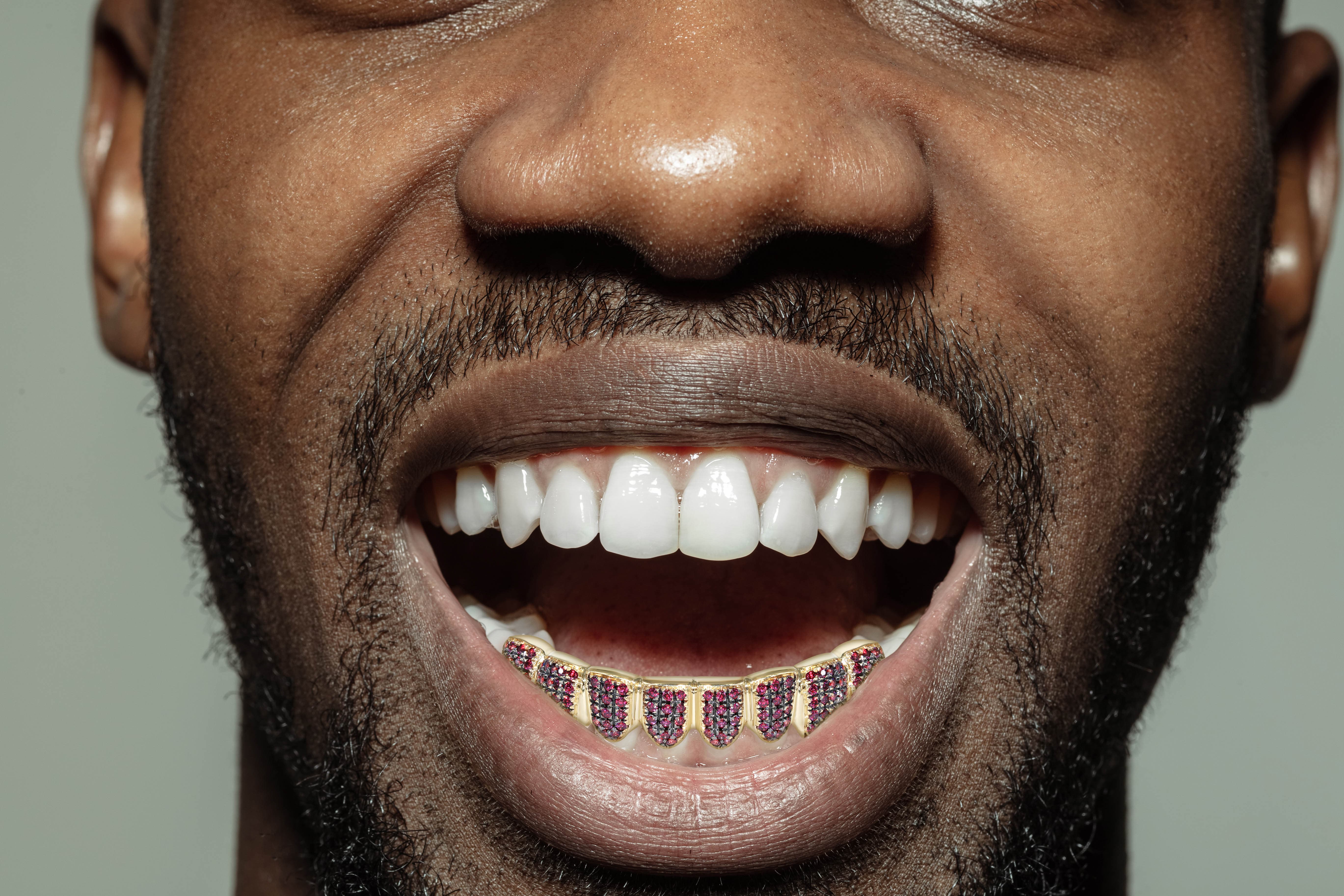 Gold 8 Teeth Ruby Grills - Image 4