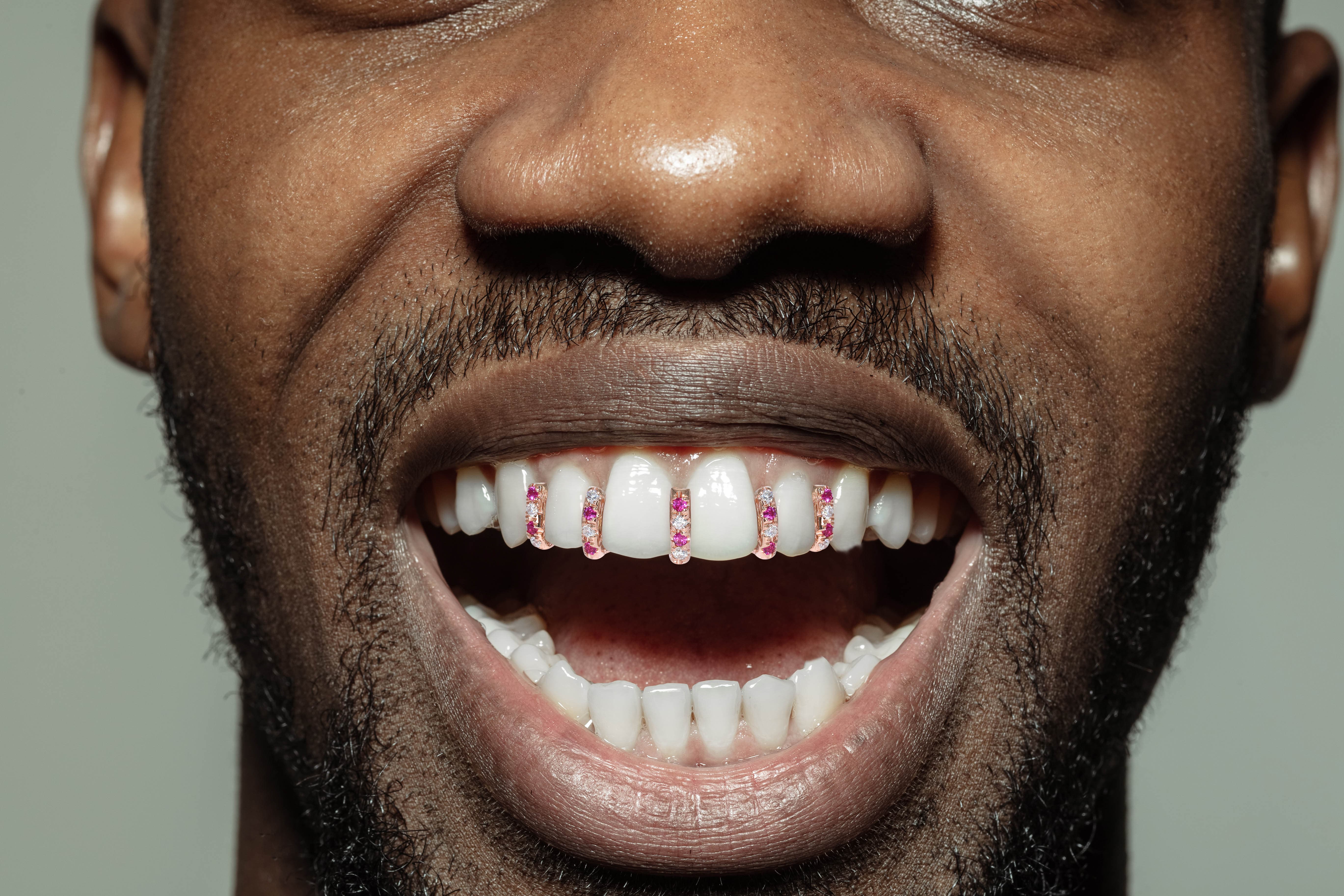4 Teeth Diamond and Pink Sapphire Grills - Image 4